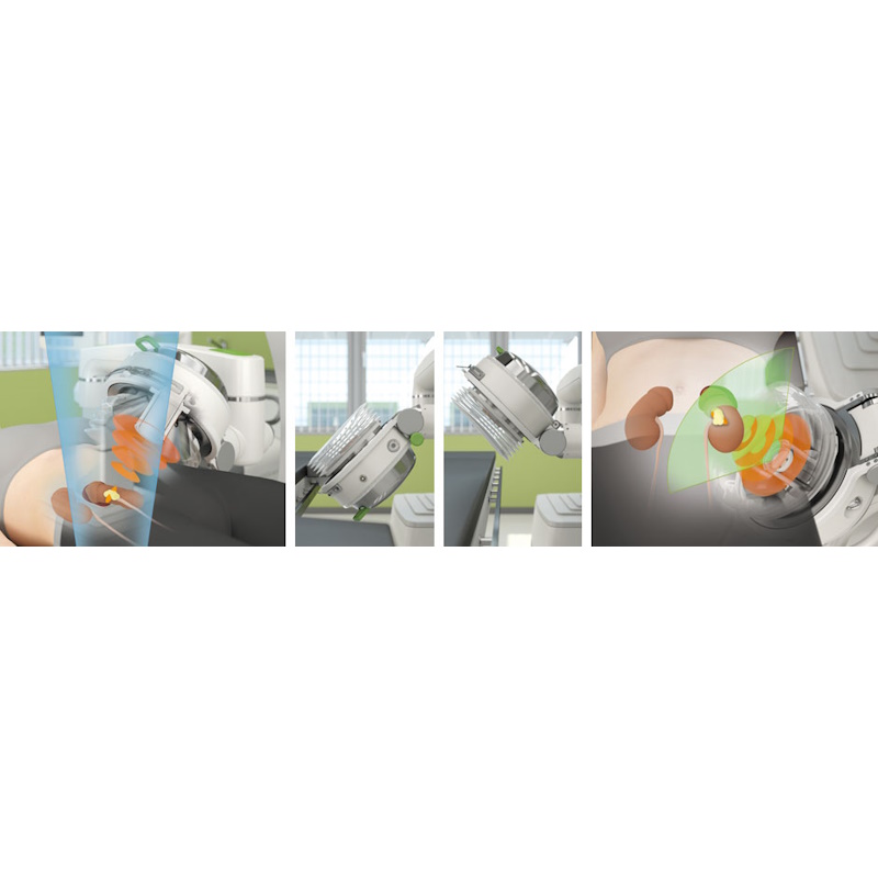 Литотриптер Storz Medical MODULITH SLK intelect